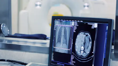 Ensuring Safety Through Customized Solution for MRI Machines and NMR Equipment